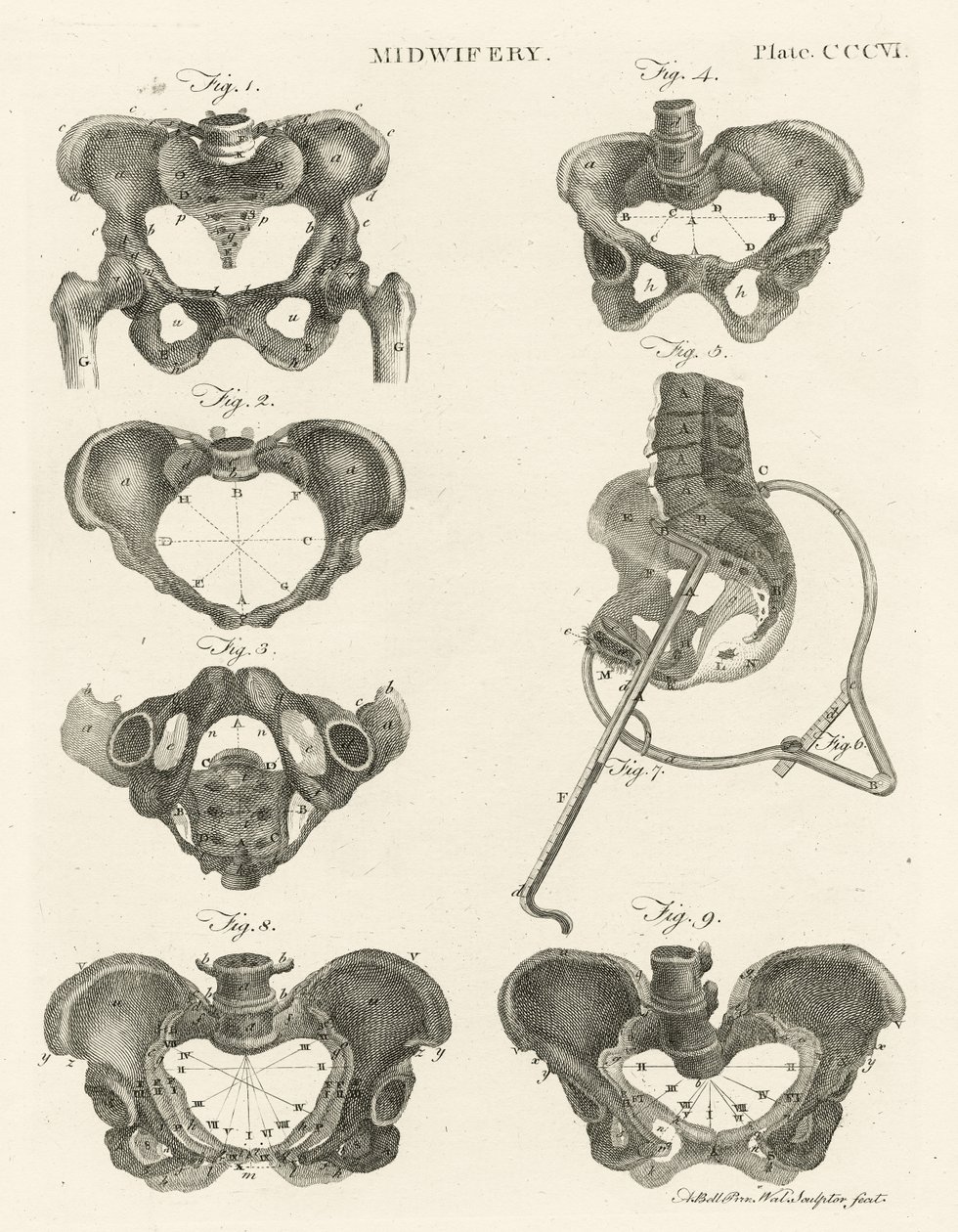Geburtshilfe, Illustration aus 