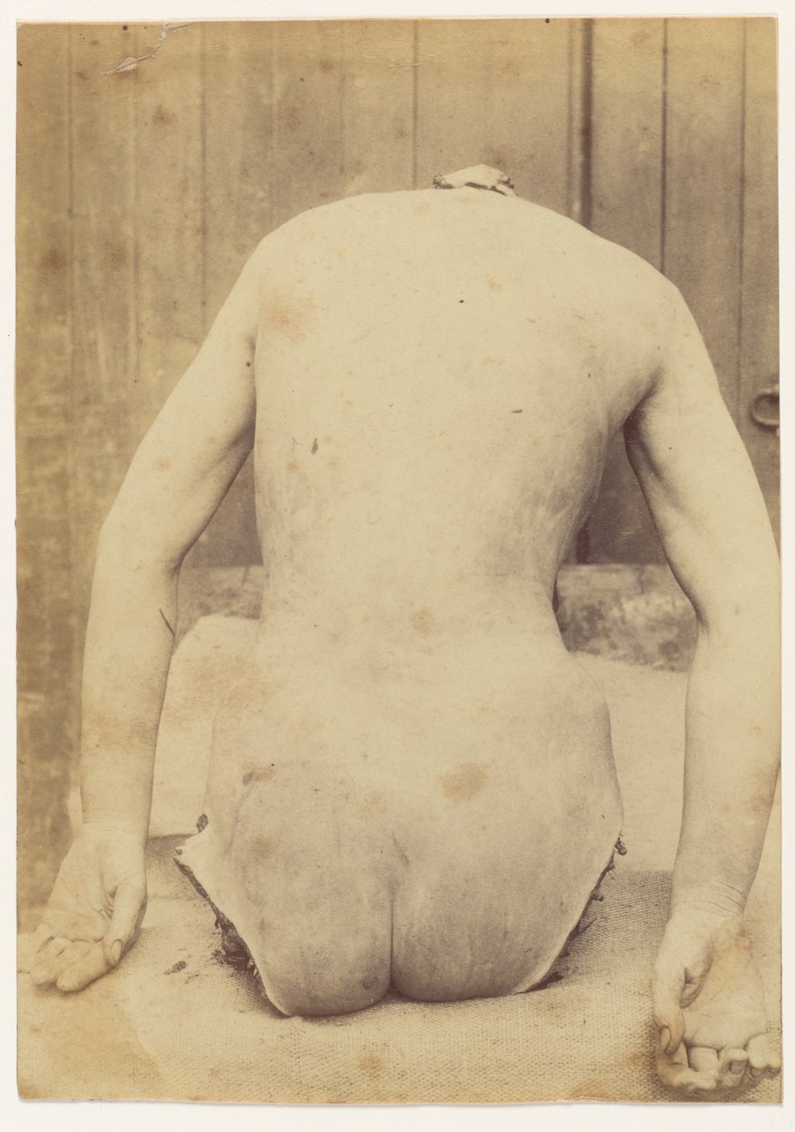 Rückansicht des Rumpfes von Alphonse Bertillon