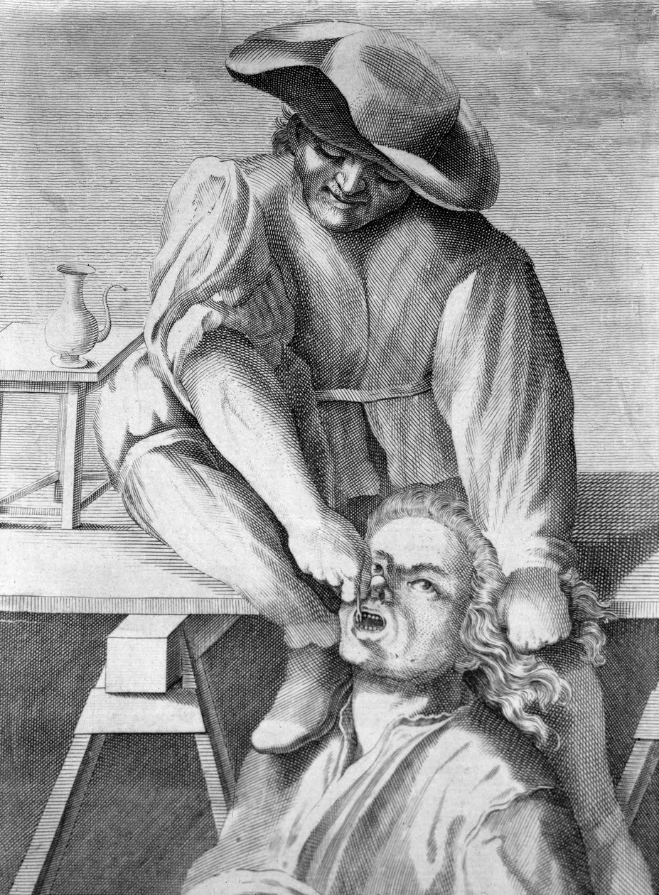 Der Zahnzieher (Gravur, 18. Jahrhundert) von Anonymous Anonymous