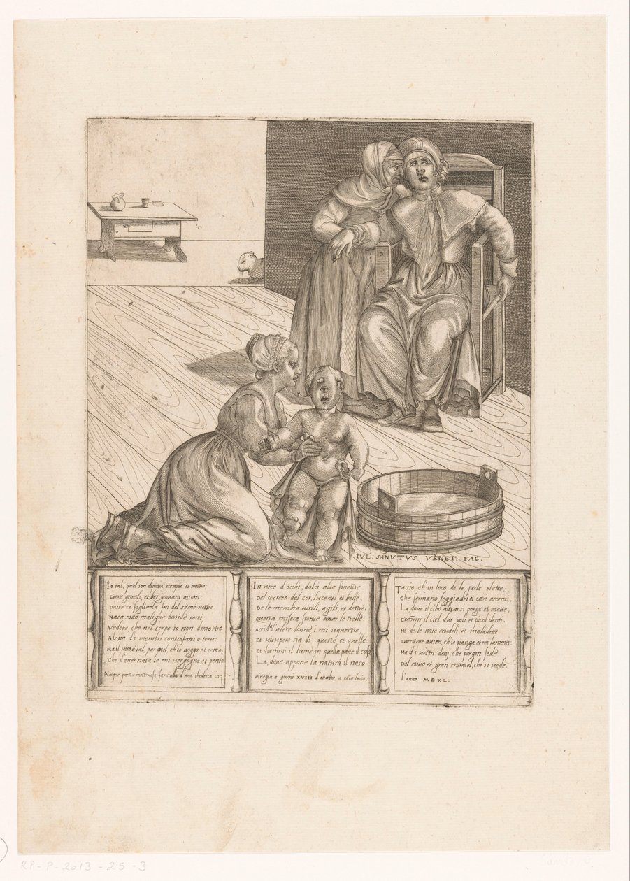 Geburt eines missgebildeten Kindes von Giulio Sanuto