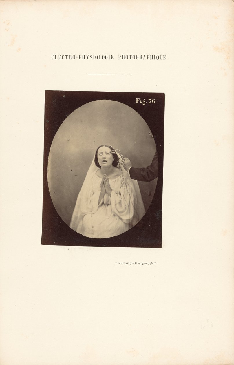 Électro-Physiologie Photographique, Abbildung 76 von Guillaume Benjamin Duchenne