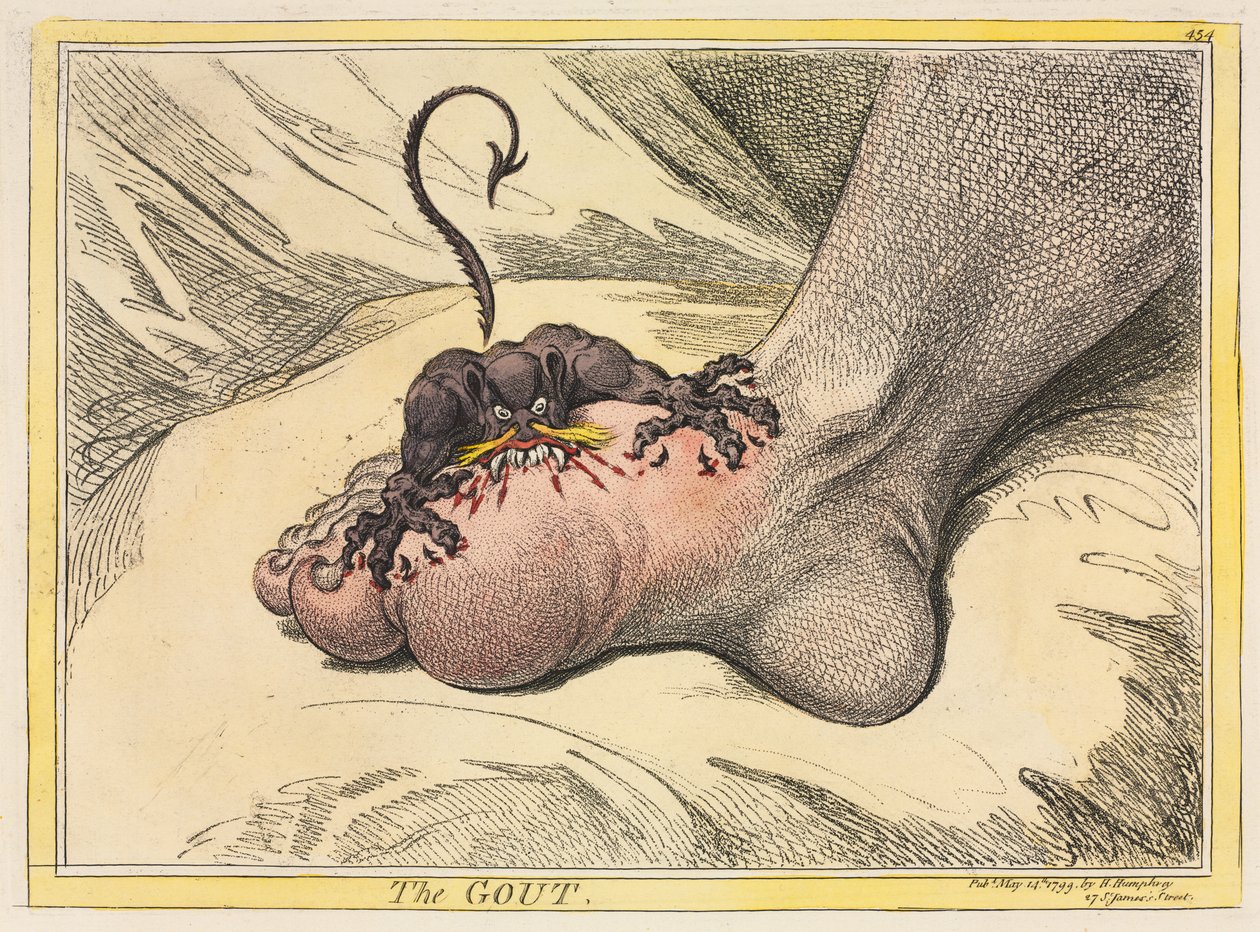 Die Gicht von James Gillray