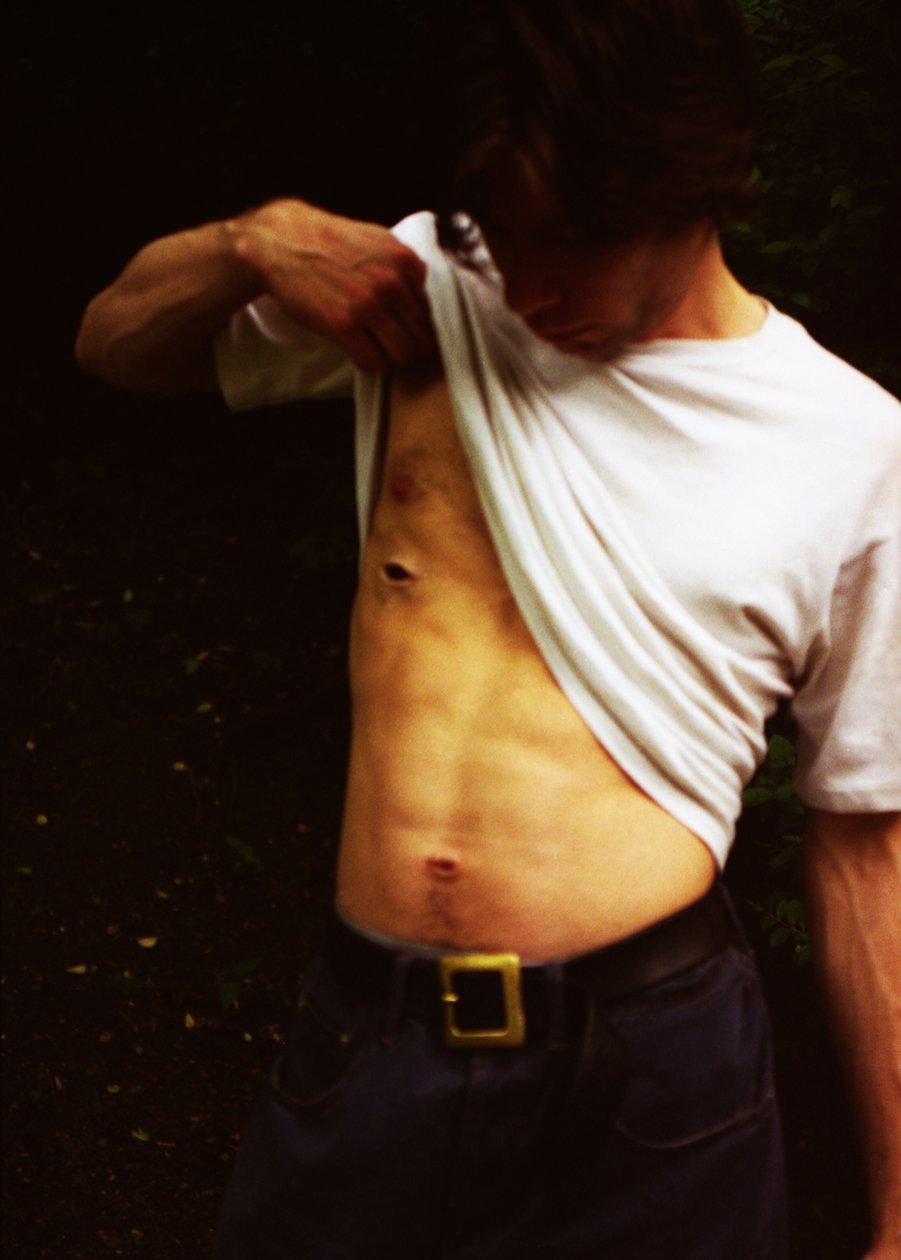 Wunde von Mat Collishaw