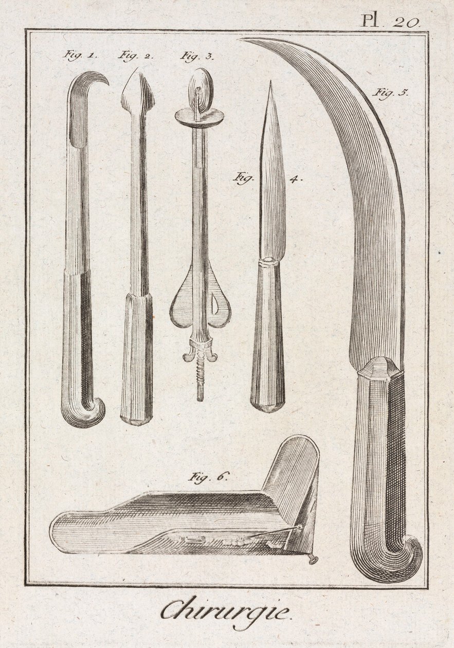 Ausrüstung, frühneuzeitliche chirurgische Messer von Unbekannt