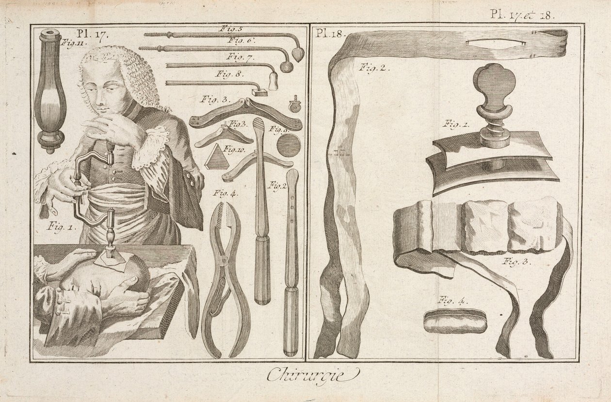 Trepanation von Unbekannt