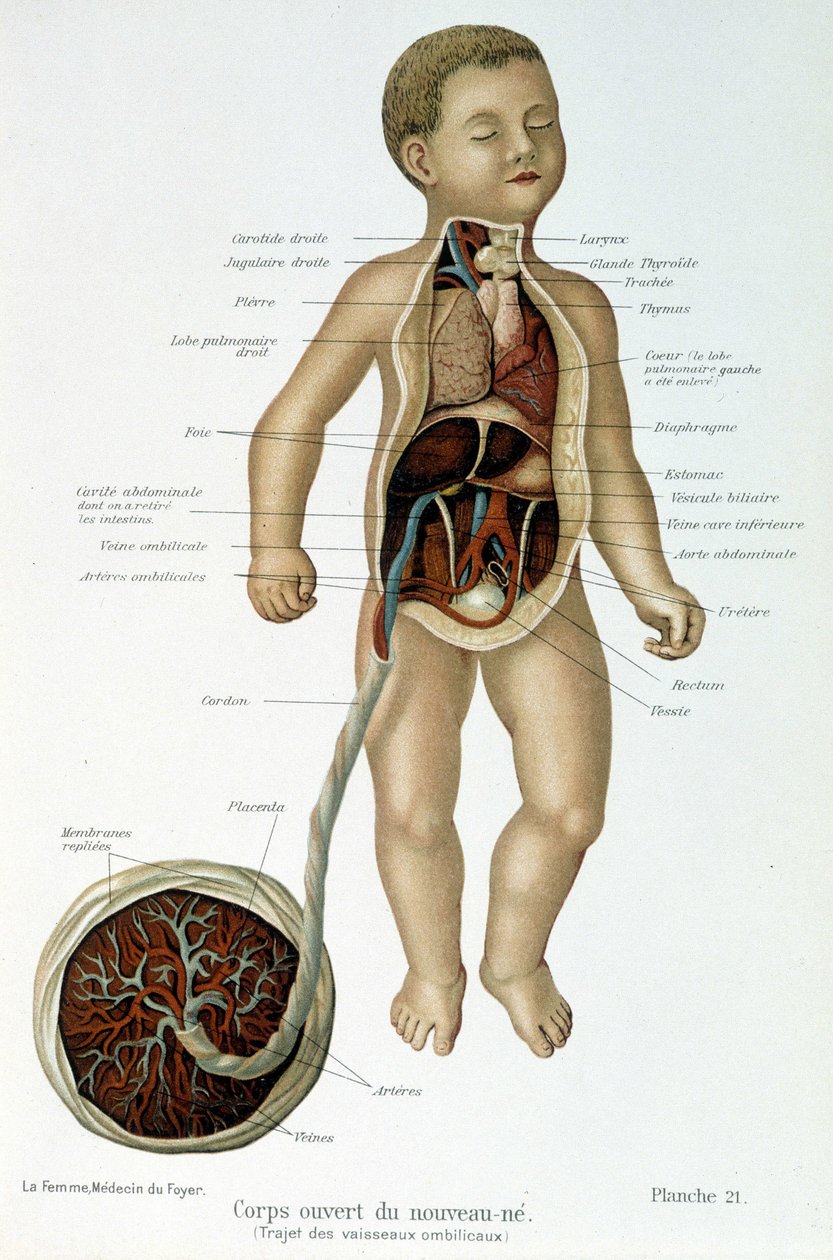 Medizin: Neugeborenes (im Brustbereich gehäutet) von Unknown artist