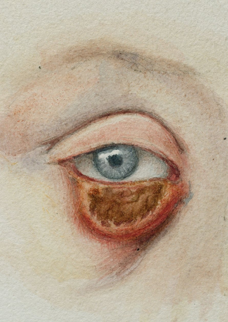 Augen von Frederick (attr. to) Barnard
