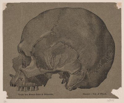 Schädel von Andreas Flinch