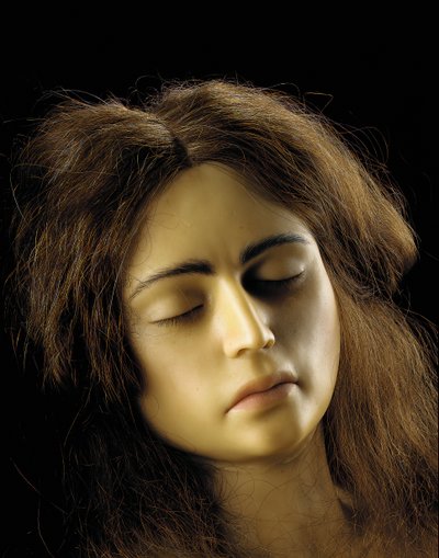 Anatomisches Modell einer Eileiterschwangerschaft (Detail) von European School