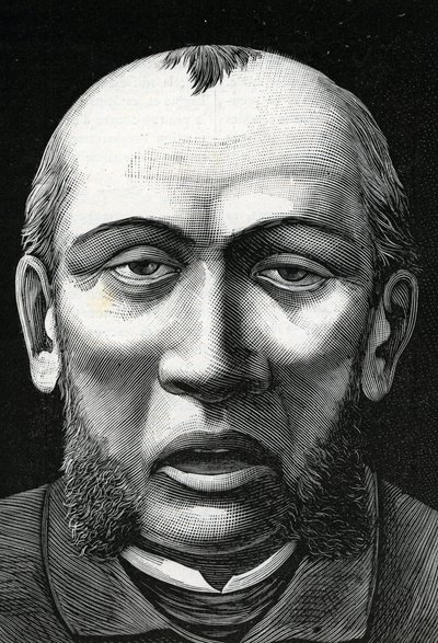Patient mit Gehirnerweichung (Gravur) 1888 von French School