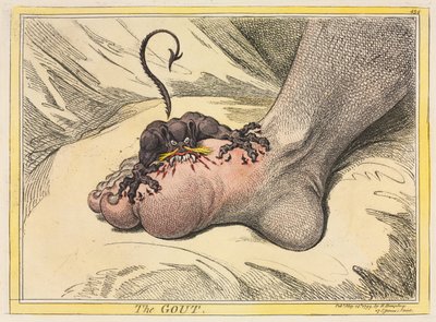 Die Gicht, 1799 von James Gillray