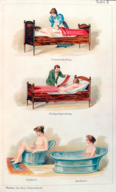 Hydrotherapie-Behandlungen, ca. 1902 von Unbekannt