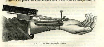 Direkter Sphygmograph von Unbekannter Künstler