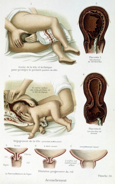 Geburt - wissenschaftliche Tafel, Ende des 19. Jahrhunderts von Unknown artist