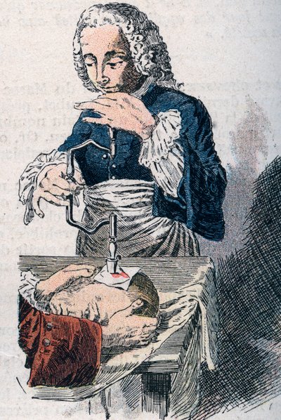 Die Trepanation. Druck des 18. Jahrhunderts. von Unknown artist